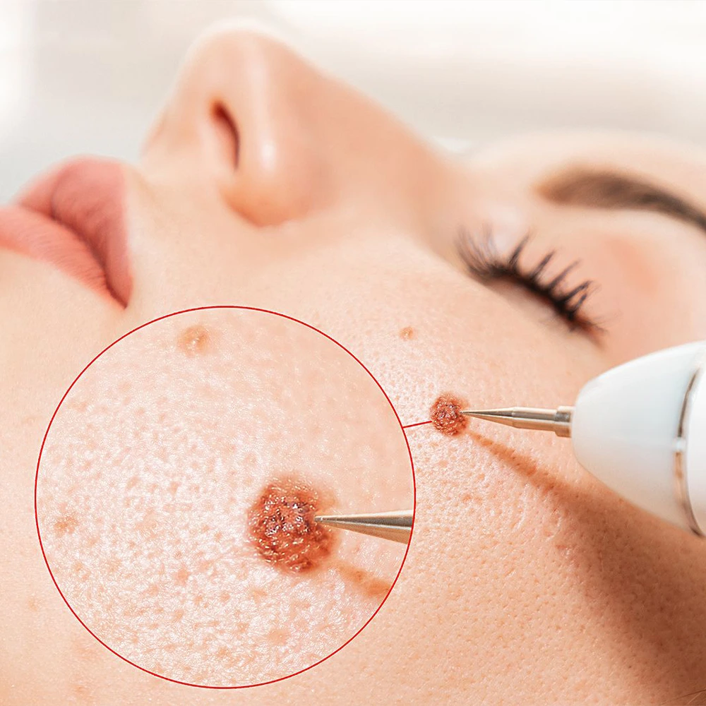 Image hover effect image