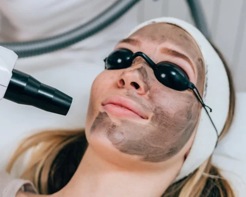 beautiful-woman-getting-carbon-face-peeling-procedure-beauty-salon