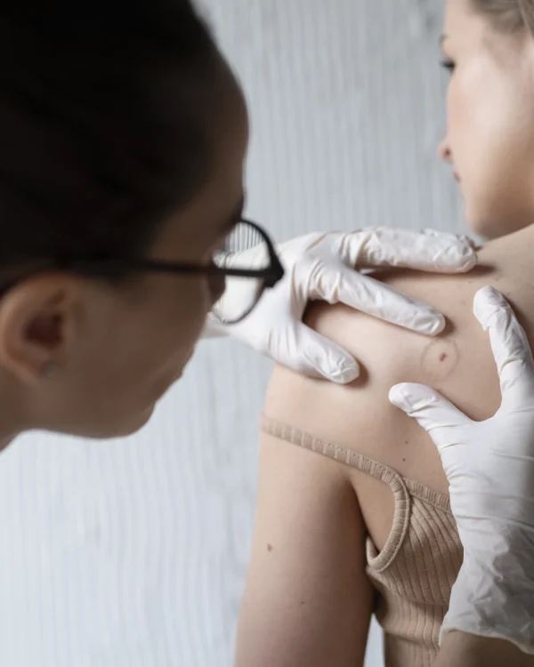 female-doctor-diagnosing-melanoma-body-female-patient